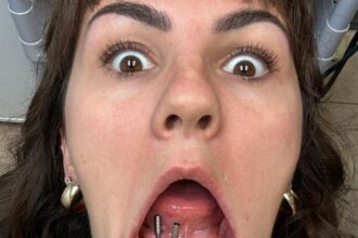 Faith Hill showing her toothless mouth.