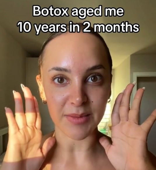 A woman shares her experience of looking "10 years older" after getting Botox in her masseter muscles, attributing the aging effects to the procedure, videos goes viral on social media.