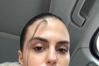 A woman embraces her unique birthmark on her forehead, despite facing cruel trolling online. Rada Prelevic, 18, shares her journey of self-acceptance, inspiring others to embrace their differences.