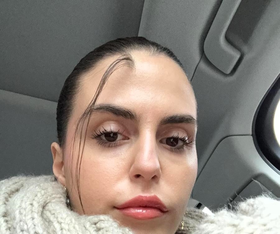A woman embraces her unique birthmark on her forehead, despite facing cruel trolling online. Rada Prelevic, 18, shares her journey of self-acceptance, inspiring others to embrace their differences.