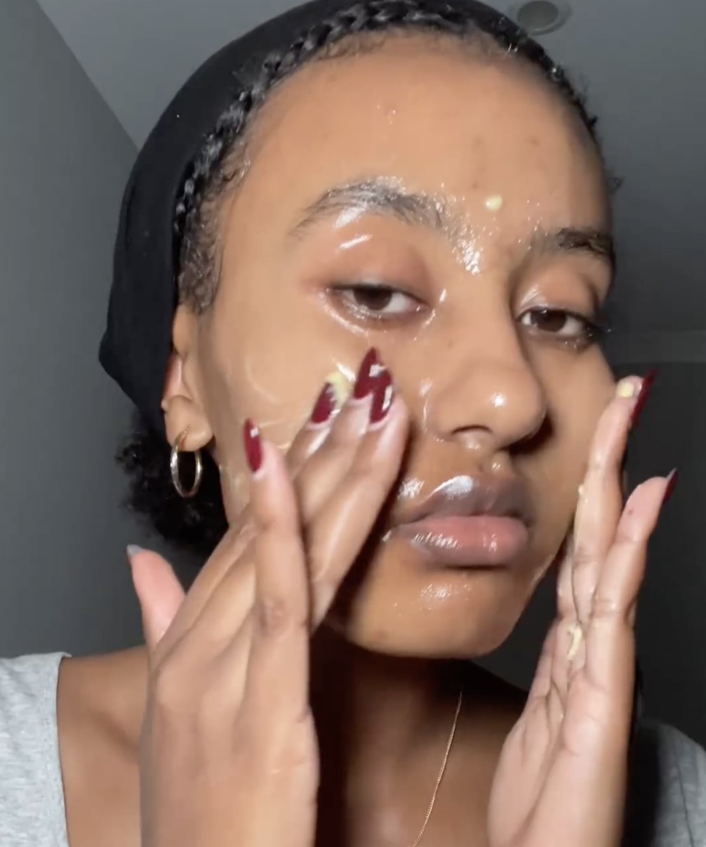 Discover the controversial skincare secret of a viral sensation: dairy butter. Kidist Begashaw shares her unconventional method for smooth, clear skin.