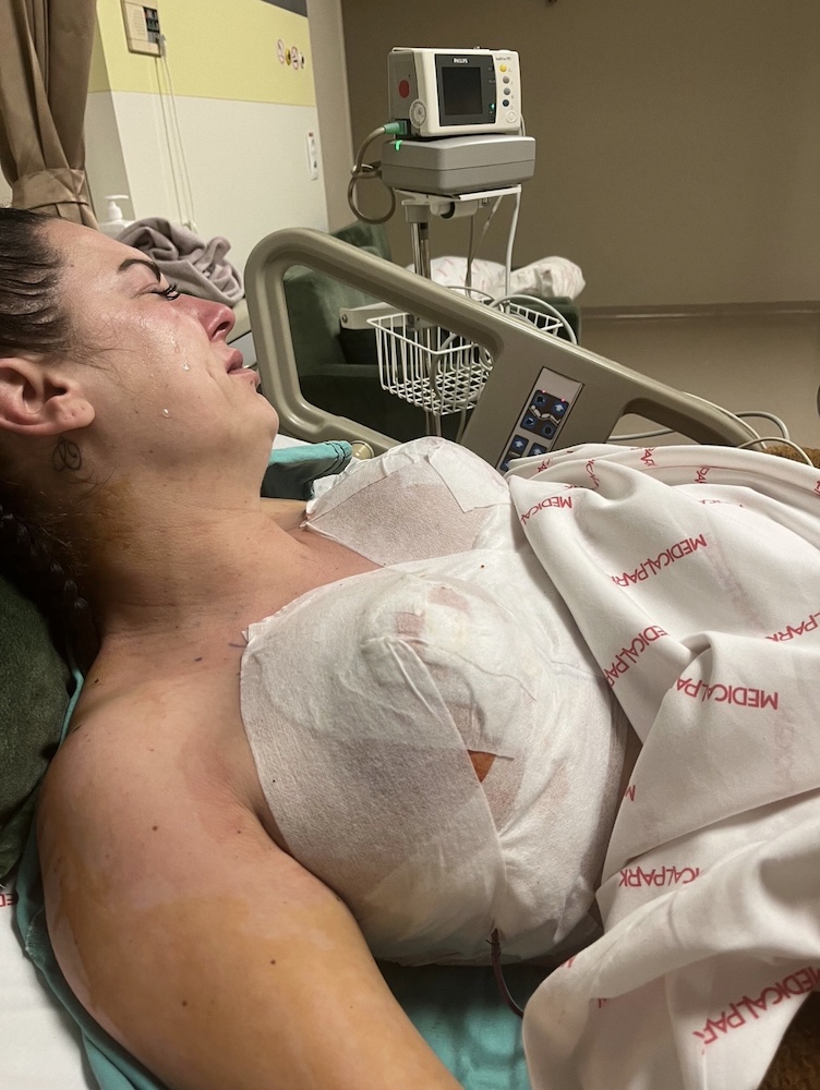 A woman shares her traumatic experience after undergoing breast reduction surgery in Turkey, leaving her with infections and permanent scarring.