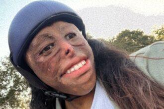 A resilient woman, Shamiam Arif, shares her journey from adversity to triumph, including completing her university studies and directing her own film, despite losing both hands in a childhood accident. Her story of perseverance and determination is truly inspiring.