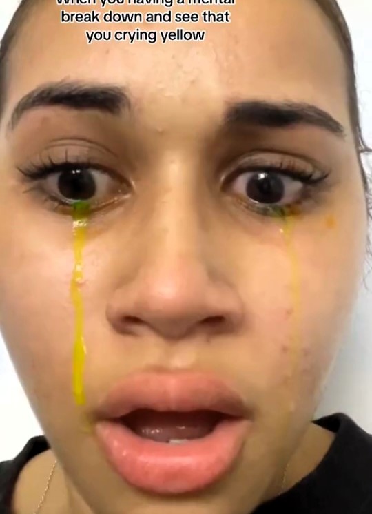 Lekeisha Pillay's TikTok video goes viral as she records herself crying yellow tears, leaving viewers baffled until she reveals it's due to an eye appointment.