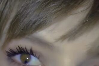Anelize Kloster, 29, from Guarapuava, Brazil, suffers from Schmid-Fraccaro syndrome, a rare condition also known as 'cat eye syndrome', which gives her elongated pupils resembling a cat's eyes.