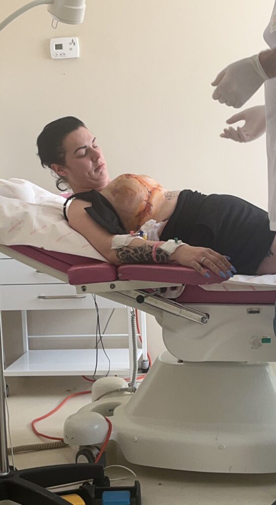 A woman shares her traumatic experience after undergoing breast reduction surgery in Turkey, leaving her with infections and permanent scarring.