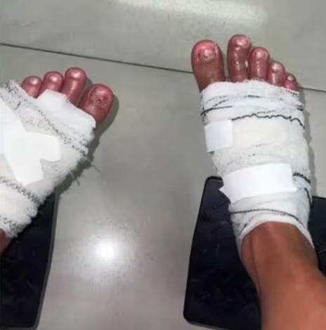 Influencer MC Thammy recounts a harrowing experience after participating in an online 'ice challenge', suffering severe burns that nearly cost her foot. The incident occurred during a reality show in Brazil, prompting apologies and medical coverage from the organizer.