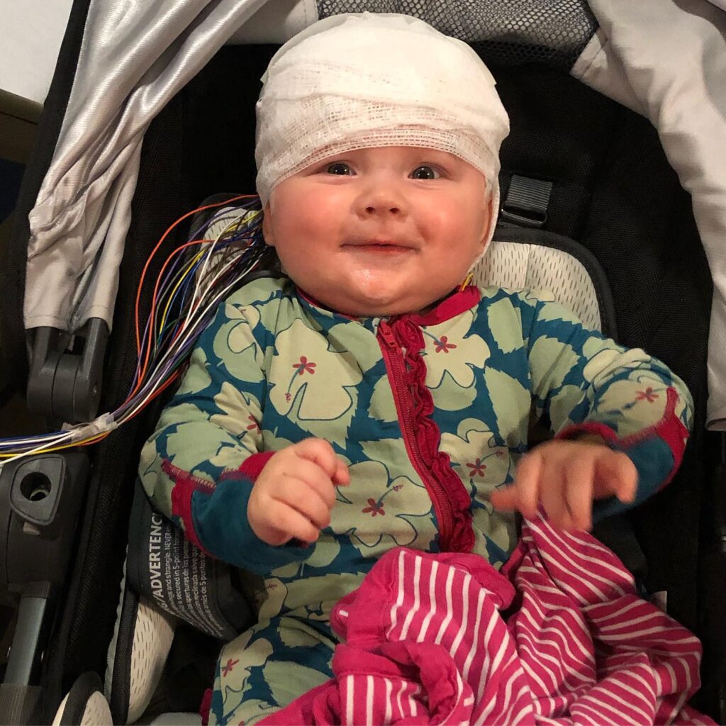 A mum shares her story of choosing treatment for her daughter's large birthmark. Addie, 4, undergoes surgeries to mitigate risks and overcome hurtful comments.