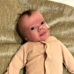 A tiny fighter, Nora, born weighing just 1lb 2oz, battles her rare condition with a contagious smile. Her parents share her feeding tube journey and resilience.