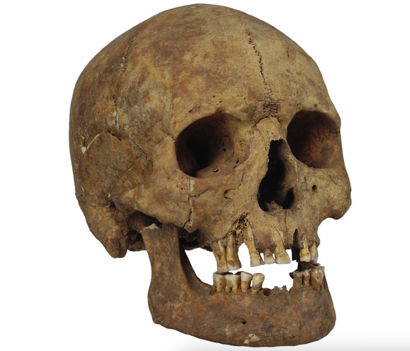 Ancient Vikings surprised researchers with their extensive body modifications, including filed teeth and skull deformations, unveiling a hidden facet of their culture.