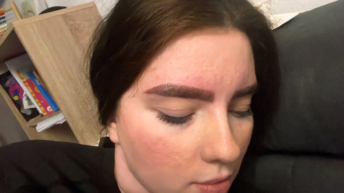 After a microblading session, Louisa Chantal was shocked to find her eyebrows resembling a piece of Lego. The nurse from Germany shared her ordeal on TikTok, sparking outrage and sympathy from viewers.