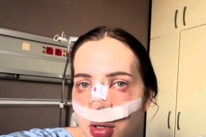 Influencer Bianca Comănici endured 33 hours of agony after a nose job in a mouldy basement in Turkey. Despite painkillers, she faced severe pain and now questions future surgeries. Her mother supported her throughout the ordeal.