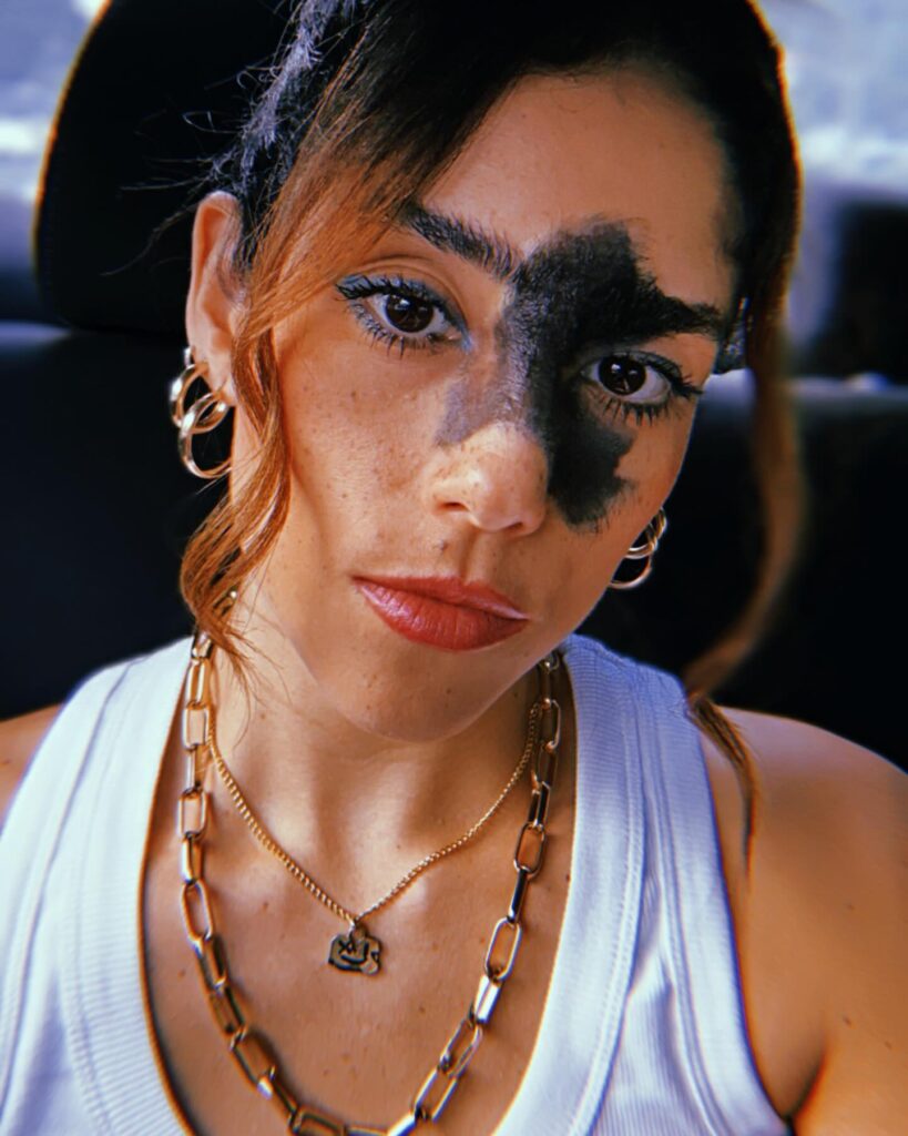 A model and influencer embraces her large facial mole, finding beauty in her uniqueness and using her platform to promote acceptance and representation in fashion.