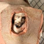 Man in Adelaide discovers face of Jesus Christ in dried blood on his heel plaster, astounding friends and sparking comments about divine healing and miraculous signs.