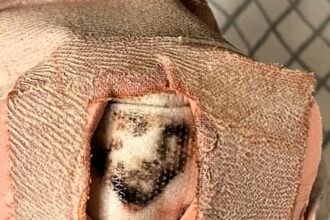 Man in Adelaide discovers face of Jesus Christ in dried blood on his heel plaster, astounding friends and sparking comments about divine healing and miraculous signs.