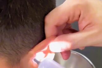 A doctor in Brasília, Brazil, revealed that he removed watermelon seeds, a grape stem, putty, and even a cockroach from children's ears. Dr. André Neri, an otorhinolaryngologist, frequently encounters kids inserting objects into their ears and noses, urging parents to seek professional help if their child shows signs of discomfort.