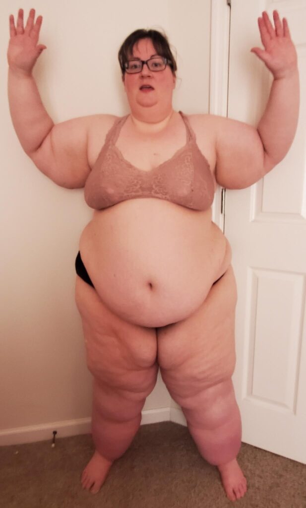Shannon Ashley Nelson, 40, shares her lifelong battle with lipoedema, a condition causing her body to continually grow. Misunderstood as "fat" in childhood, Shannon’s condition led to immense pain and isolation.