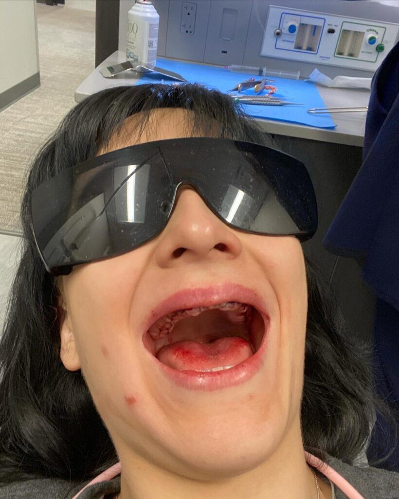 Courtney Luna, 29, wears dentures after a lifelong battle with tooth decay due to enamel deficiency. Despite surgeries and costs, she's now confident with her new smile.