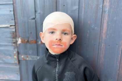 A five-year-old boy surprises teachers by dressing up as Everton manager Sean Dyche for sports week, opting for a unique look instead of the usual footballer attire.