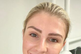 Skincare specialist warns against trendy treatments like microneedling, hydrafacials, and face yoga. Learn why these popular procedures may not be worth it.