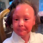 A mum shares her heartbreaking story of her daughter Harper, born with rare harlequin ichthyosis despite a normal pregnancy. The 8-year-old's unique condition requires intensive daily care.