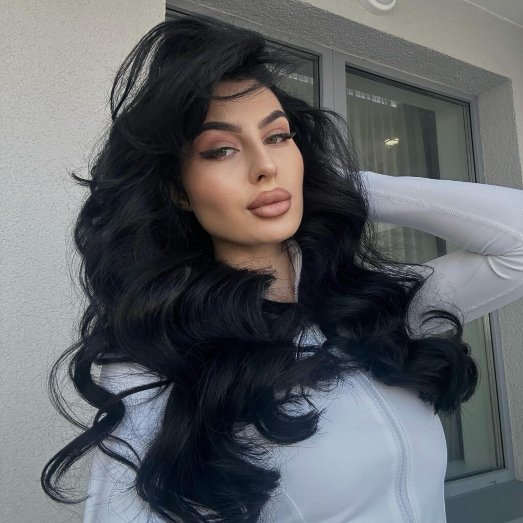 Influencer Sofia Bolshakova, 23, was left looking like Snoopy after a severe allergic reaction to lip filler removal. Thanks to quick action, she's now recovering and warning others.