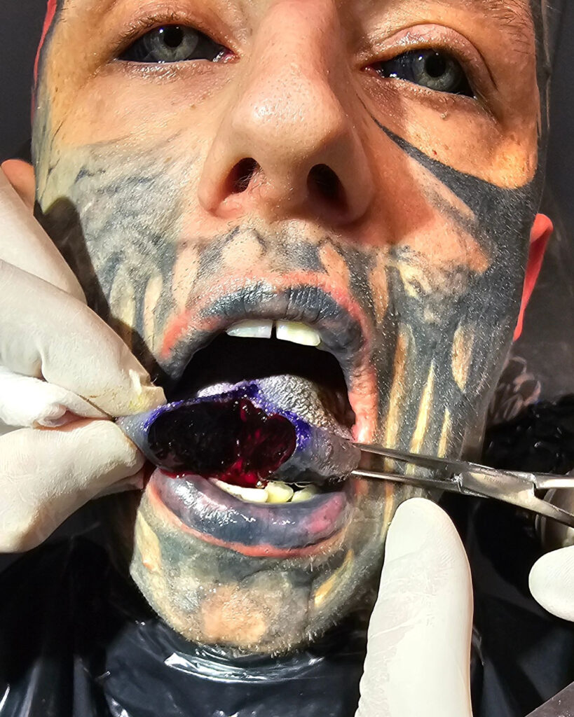 Body mod addict Juliusz Krause showcases his extreme transformations, including inked eyeballs and transdermal implants. Despite risks, he plans more high-risk modifications.