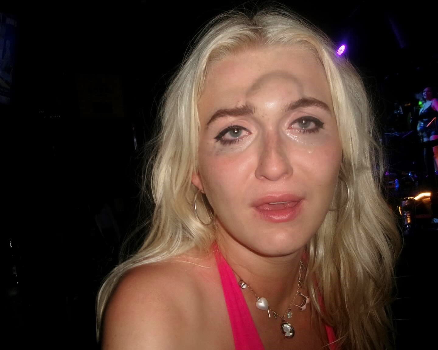 A 23-year-old woman, Lexi DiLucia, ended a night out with a massive forehead bump after a splits fail at a club. Her viral video, with 7.4m views, captures the hilarious moment and the aftermath.
