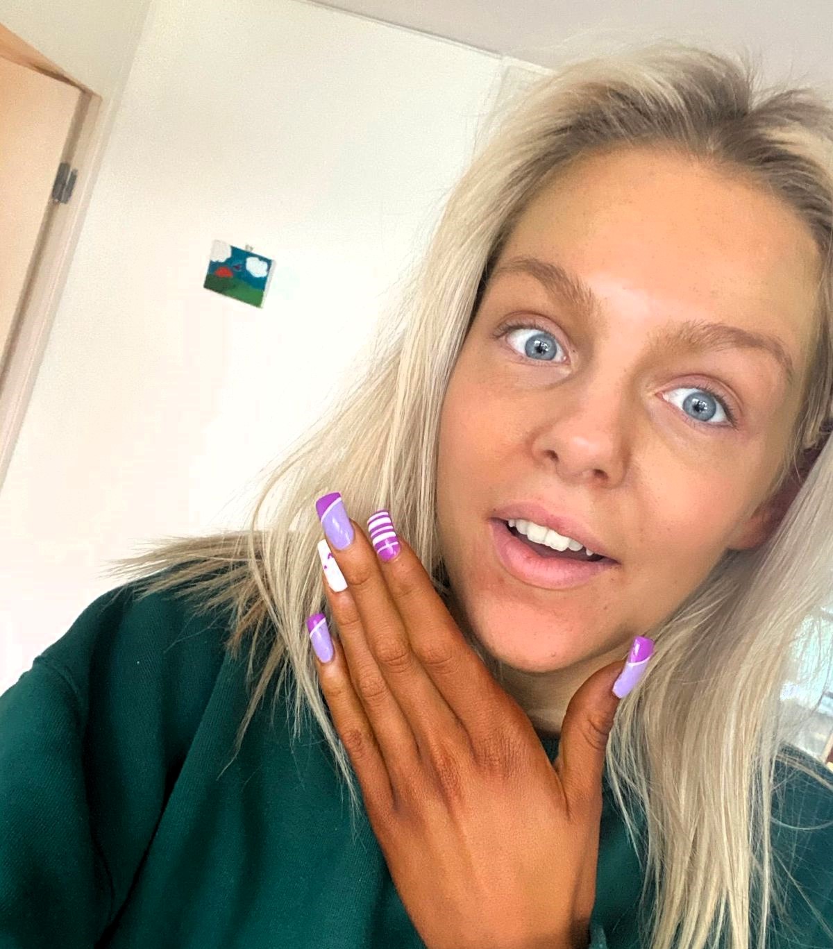 A woman turned bright orange after a spray tan mishap, leading to hilarious comparisons to cheese Doritos. Iris Owen from London took it in stride and shared her story on TikTok.