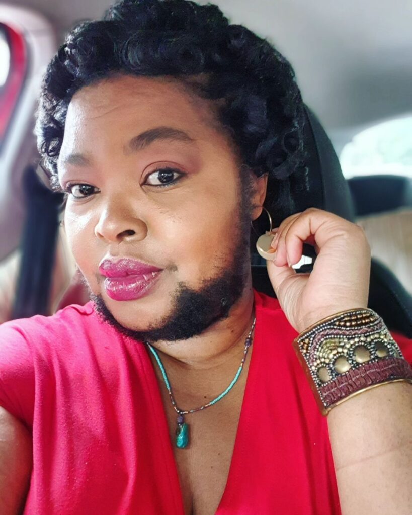 Bearded woman Khosi Nkanyezi Buthelezi shares her summer beard care routine and tips for self-acceptance, embracing her unique look with confidence despite societal reactions.