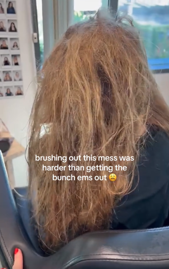 A 10-year-old girl narrowly avoided a hair disaster after getting 57 Bunchems toys stuck in her hair, with her hairdresser aunt spending hours to carefully remove them.