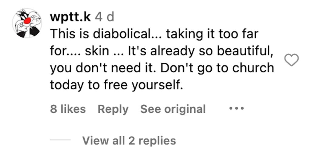 Social media comment on the post of Influencer Débora Peixoto shocks with faeces face mask skincare routine, garnering 217,000 views. Doctors warn of severe health risks, urging safer, scientifically-backed alternatives.