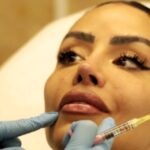 Influencer Chloe Saxon, 36, shares her ongoing cosmetic surgery journey with 1.1M followers, spending thousands annually on procedures like rhinoplasty and Profhilo treatments.