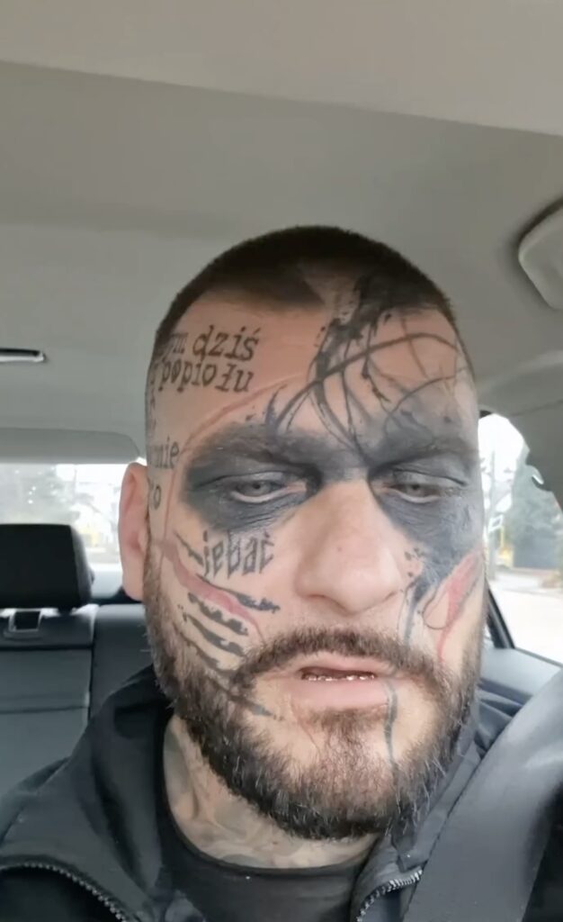 Polish rapper Popek, known for his extensive face tattoos, undergoes painful removal procedures, expressing regret over past decisions influenced by alcohol and ex-relationships.