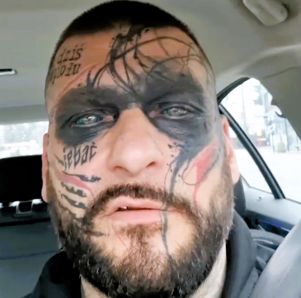 Polish rapper Popek, known for his extensive face tattoos, undergoes painful removal procedures, expressing regret over past decisions influenced by alcohol and ex-relationships.