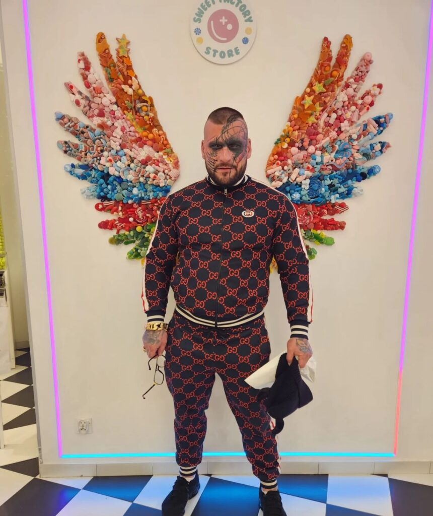 Polish rapper Popek, known for his extensive face tattoos, undergoes painful removal procedures, expressing regret over past decisions influenced by alcohol and ex-relationships.