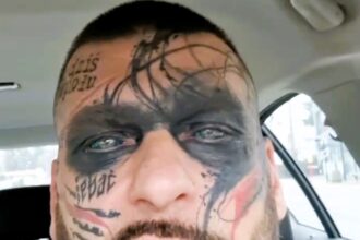 Polish rapper Popek, known for his extensive face tattoos, undergoes painful removal procedures, expressing regret over past decisions influenced by alcohol and ex-relationships.