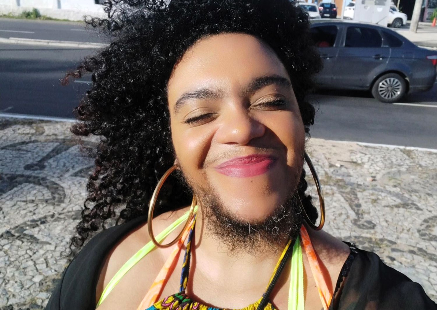 A singer who spent years hiding her beard due to a rare condition now embraces it, inspiring fans with a powerful message of self-acceptance and individuality.