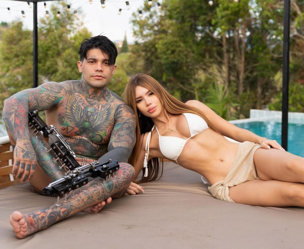 Colombian influencer Yeferson Cossio reveals cost of painful leg-lengthening surgery, gaining several inches in height and sharing his journey with 12 million followers.