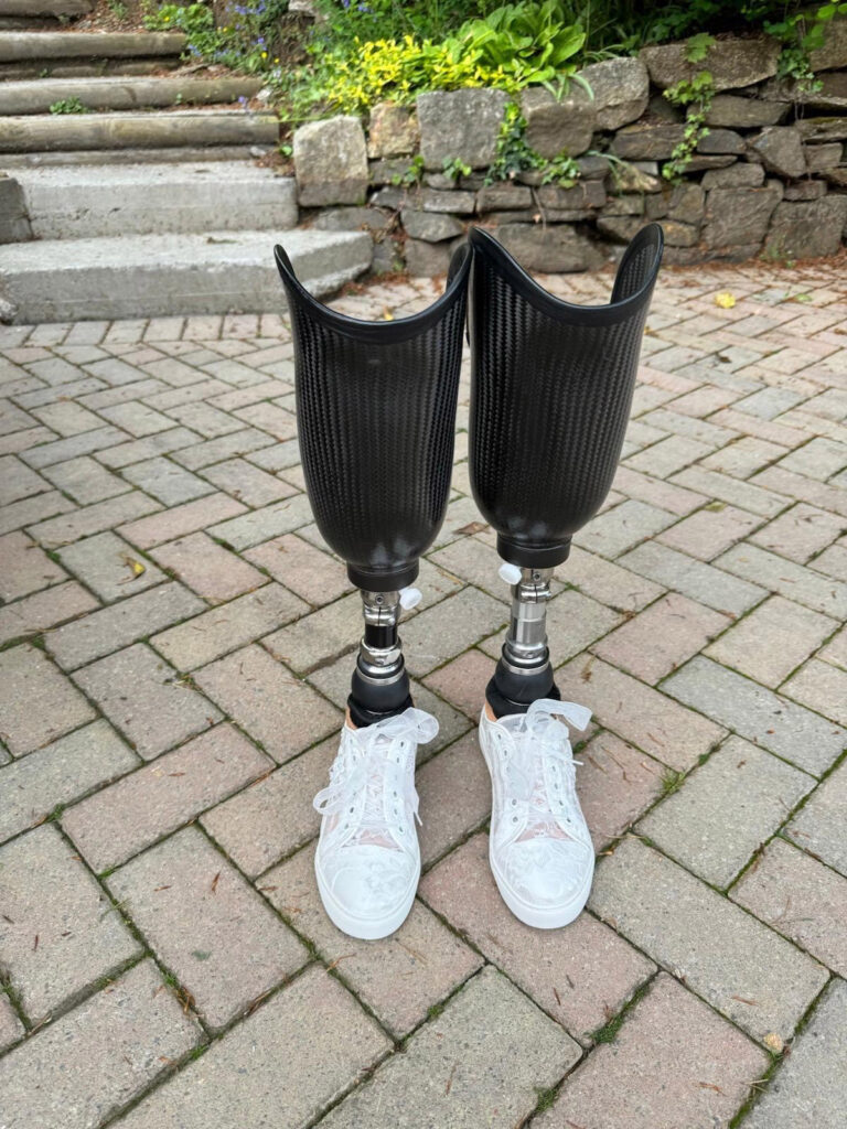 A nurse who lost her legs and fingers to sepsis walks down the aisle using prosthetics in a heartwarming ceremony, inspiring hope and resilience.