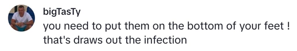 Social media comment on the post of Woman goes viral with 18M TikTok views after trying Amish onion poultice for persistent cough.