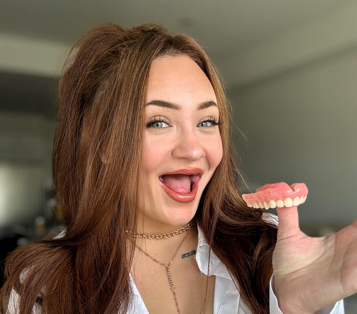 Woman opens up about intimacy challenges with dentures, overcoming self-confidence struggles after losing her teeth at 19, and embracing a newfound smile with support from her partner.