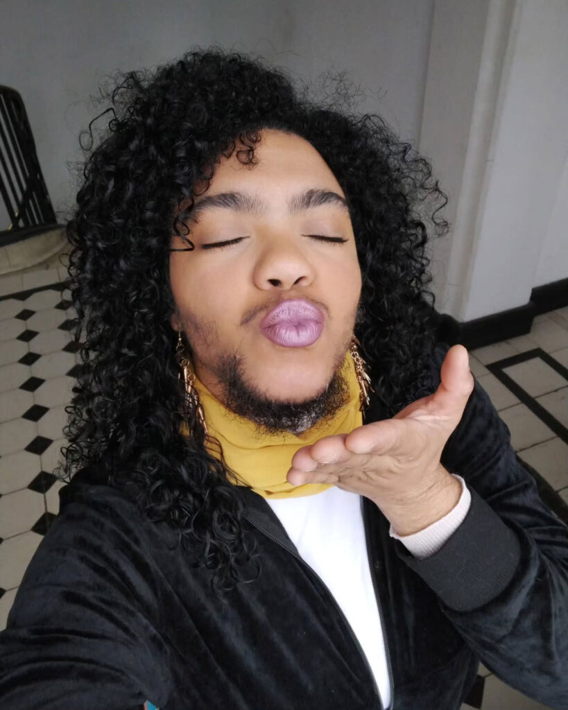 A singer who spent years hiding her beard due to a rare condition now embraces it, inspiring fans with a powerful message of self-acceptance and individuality.