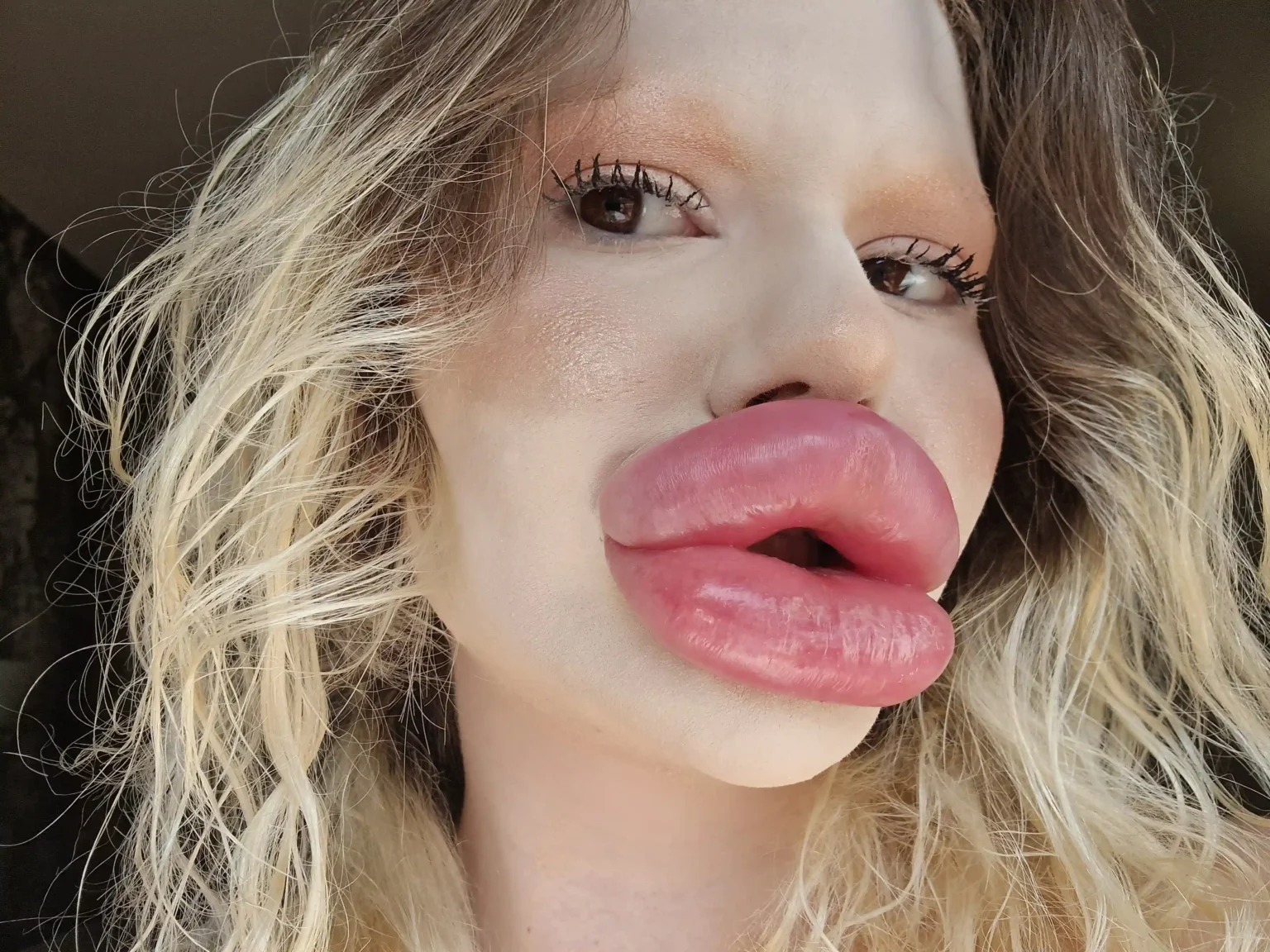 Andrea Ivanova, known for her £20k 'world’s biggest lips,' shifts focus to a festive bum filler transformation.