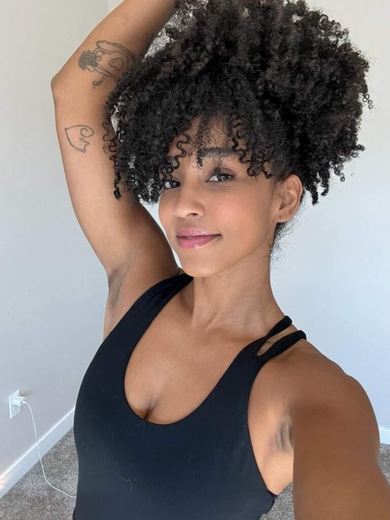 Victoria Esteves, 27, has hit back at trolls shaming her for her dark armpits, embracing her natural hyperpigmentation and promoting self-acceptance on social media.