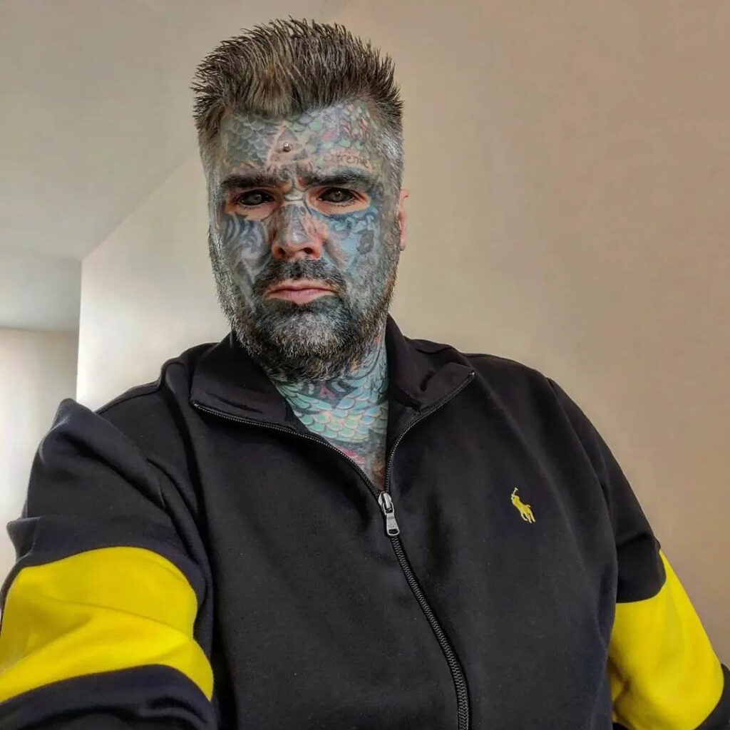 "Britain's most tattooed man," King Of Ink Land, seeks to remove his body implants but faces legal barriers in the UK. He urges reform to allow licensed body modification practitioners.