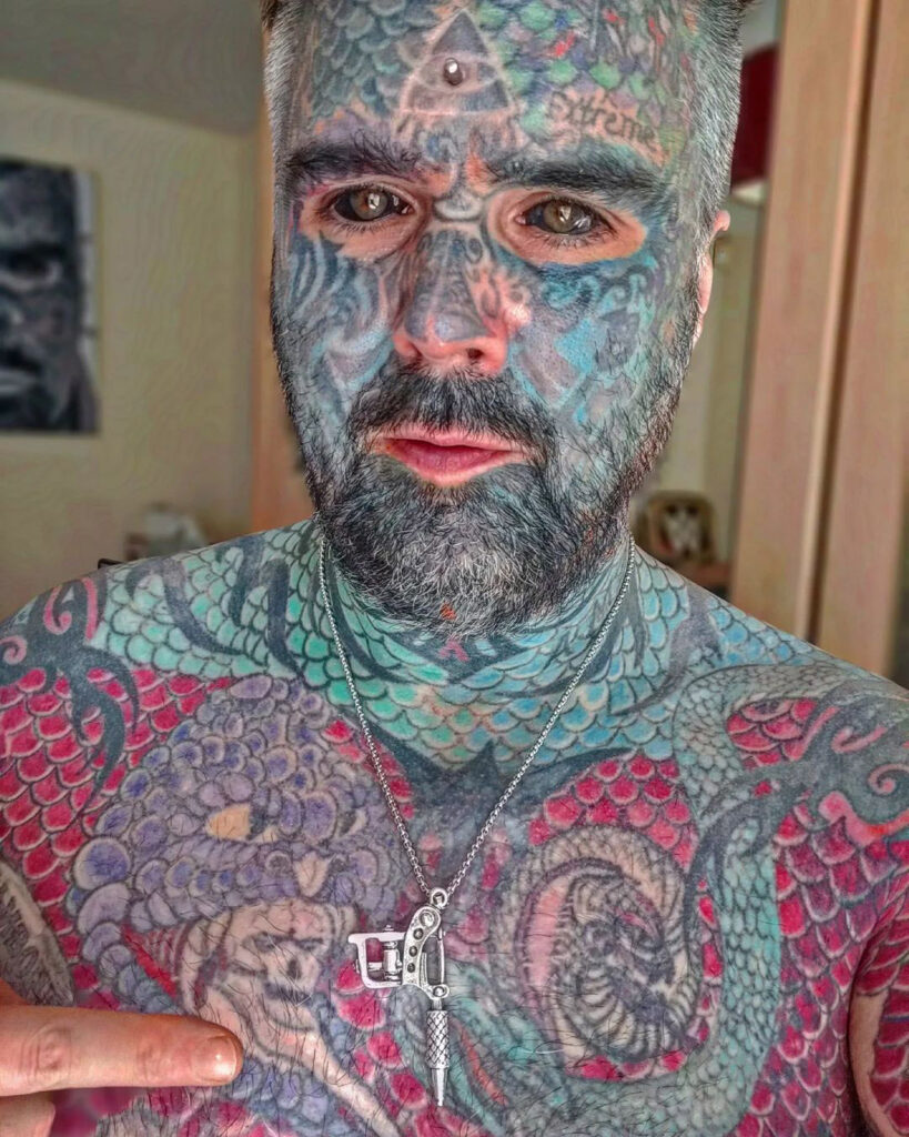 "Britain's most tattooed man," King Of Ink Land, seeks to remove his body implants but faces legal barriers in the UK. He urges reform to allow licensed body modification practitioners.