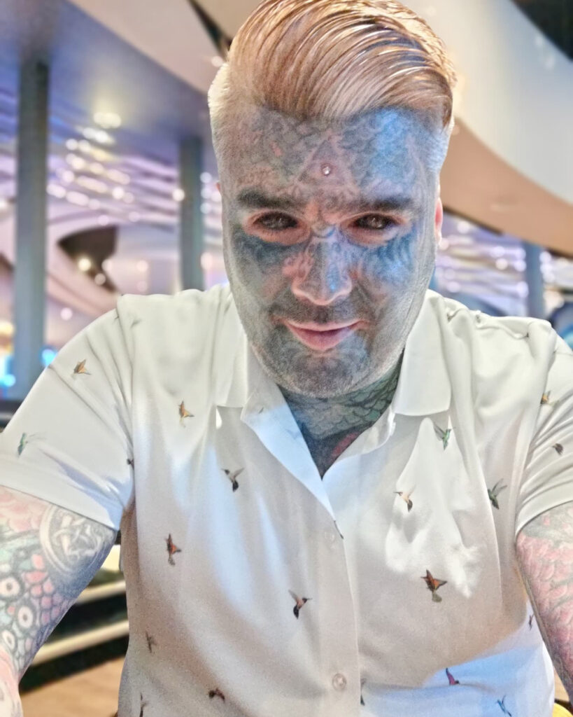 "Britain's most tattooed man," King Of Ink Land, seeks to remove his body implants but faces legal barriers in the UK. He urges reform to allow licensed body modification practitioners.