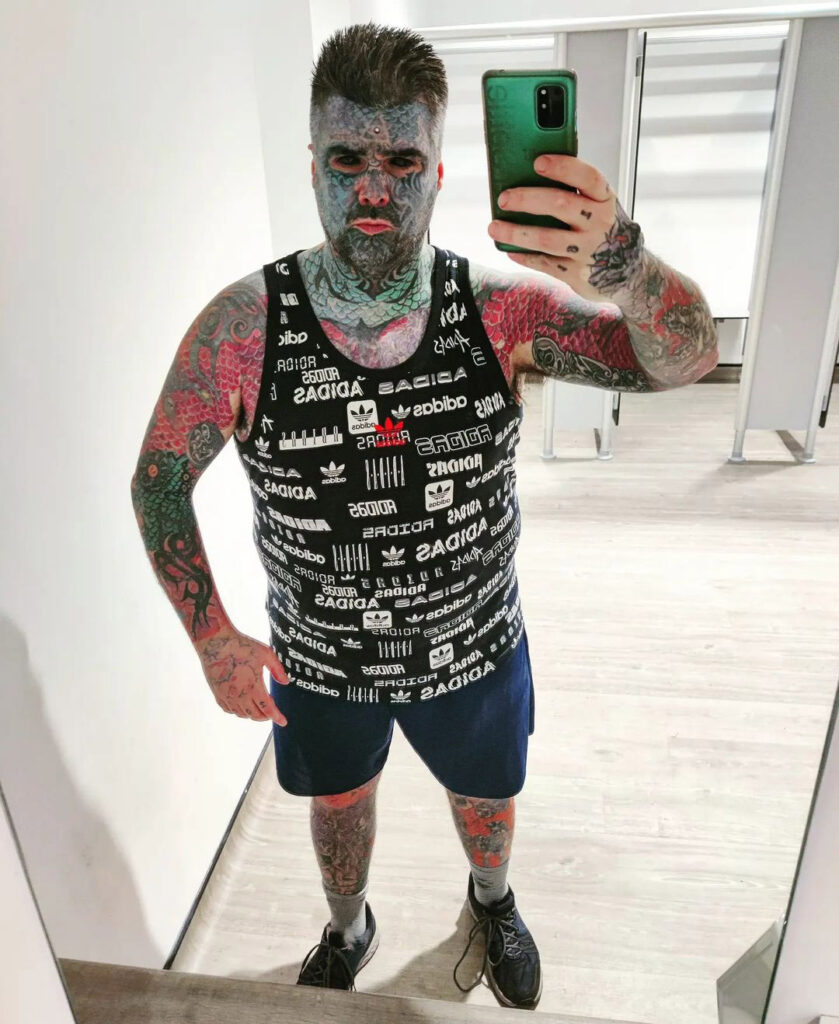 "Britain's most tattooed man," King Of Ink Land, seeks to remove his body implants but faces legal barriers in the UK. He urges reform to allow licensed body modification practitioners.