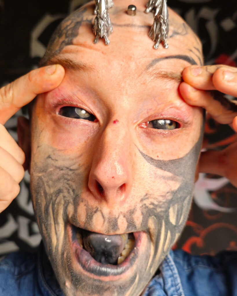 A body modification enthusiast, transforming into a ‘reptilian,’ gets silicone implants in his skull to achieve a cohesive lizard-inspired look, sparking mixed reactions.